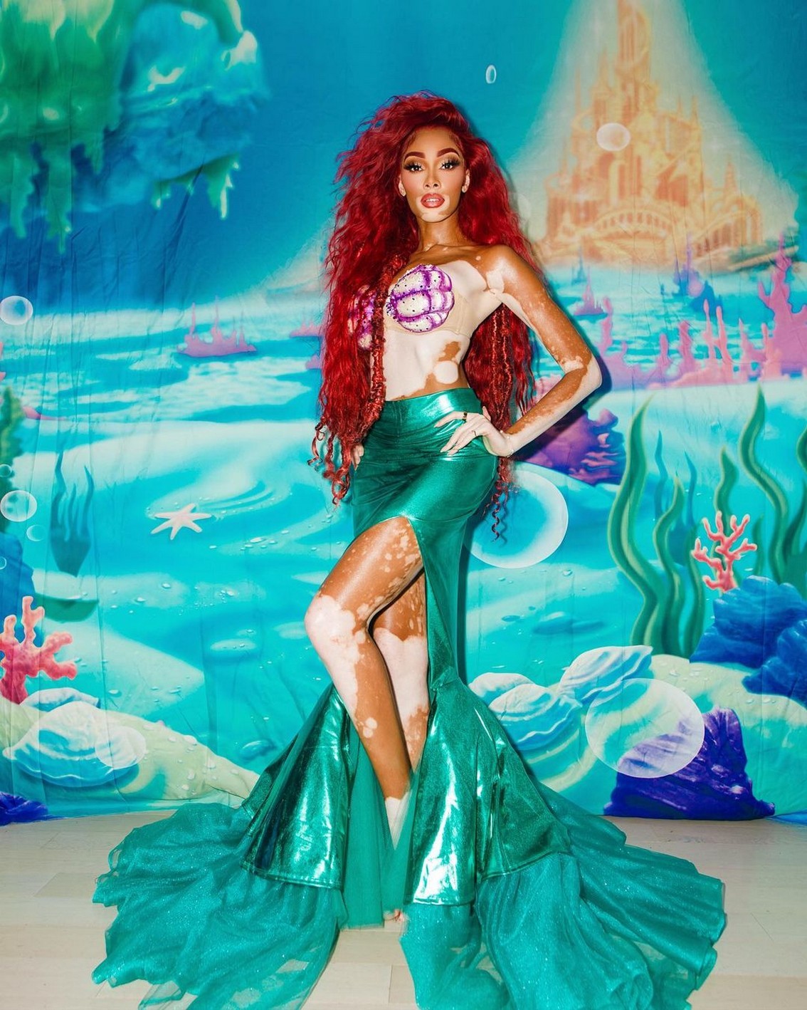 Winnie Harlow Sexy Marmaid TheFappening.Pro 7 - Winnie Harlow Sexy Mermaid (7 Photos)
