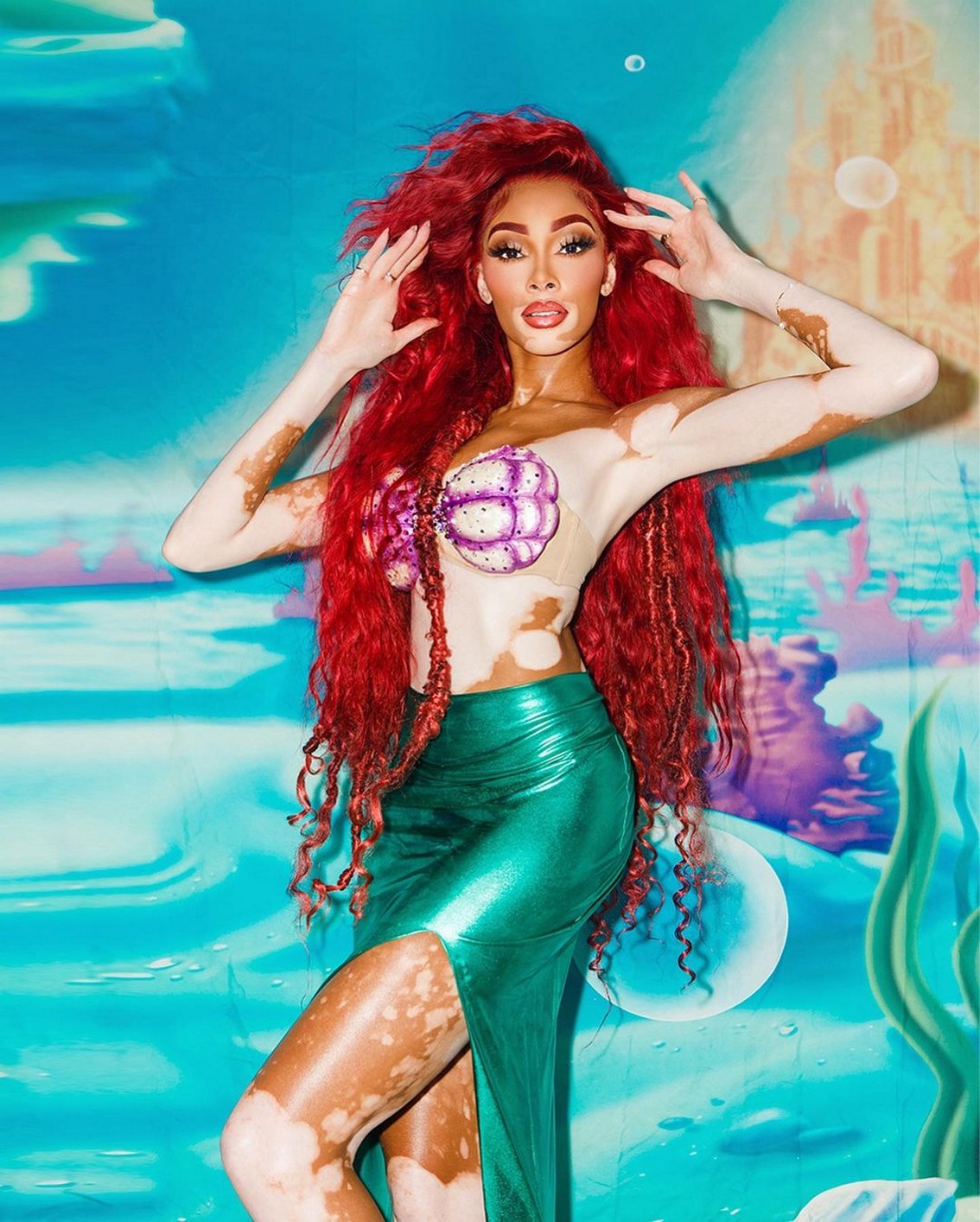 Winnie Harlow Sexy Marmaid TheFappening.Pro 1 - Winnie Harlow Sexy Mermaid (7 Photos)