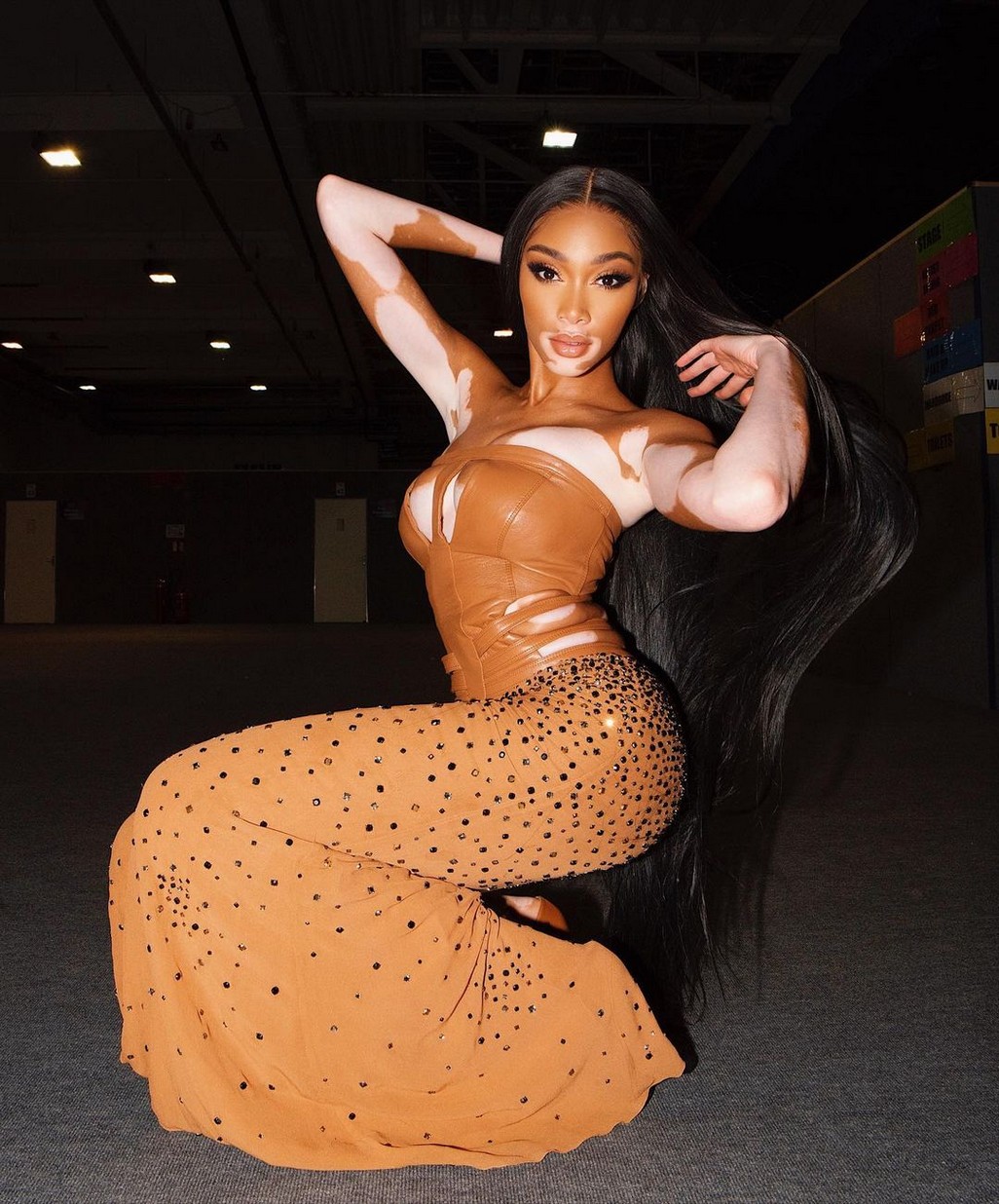 Winnie Harlow Sexy TheFappening.Pro 1 - Winnie Harlow Sexy In Versace (7 Photos And Video)