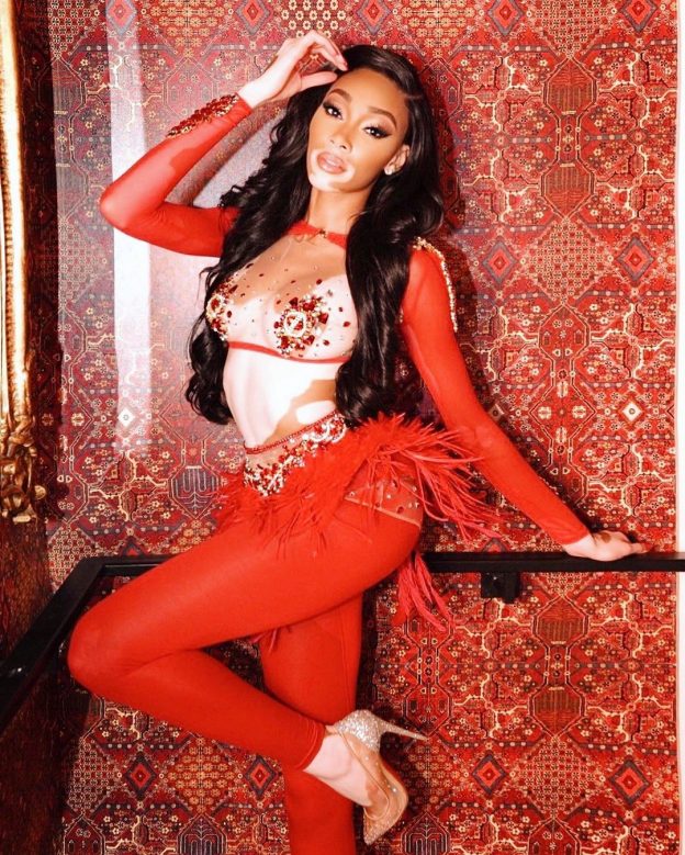 Winnie Harlow Sexy TheFappening.Pro 6 624x779 - Winnie Harlow Sexy In Versace (7 Photos And Video)