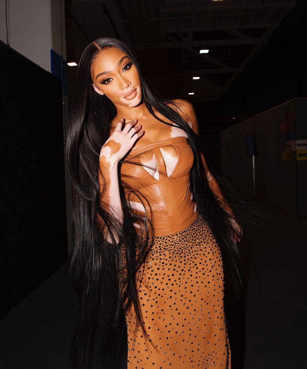 Winnie Harlow Sexy TheFappening.Pro 7 - Winnie Harlow Sexy In Versace (7 Photos And Video)