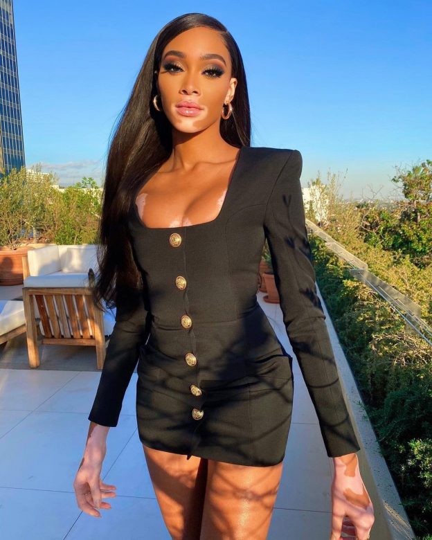 1680877937 665 Winnie Harlow Sexy In Tiny Black Dress TheFappening.Pro 8 624x780 - Winnie Harlow Sexy After Two Months Of Self-Isolation (6 Photos)