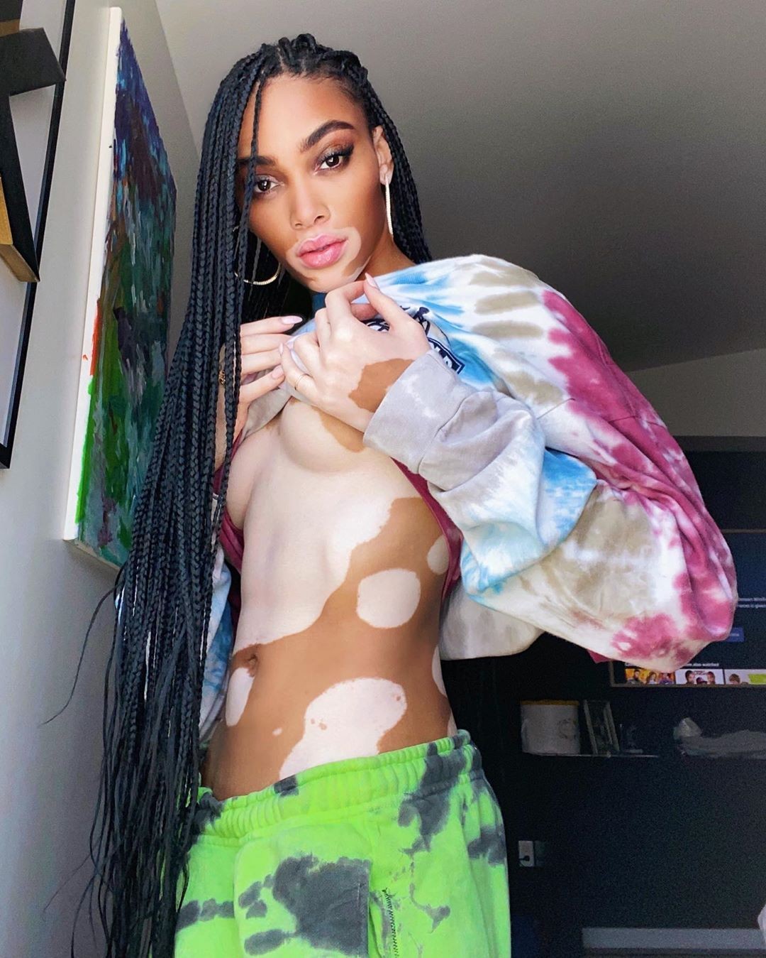 Winnie Harlow Sexy After Self Isolation TheFappening Pro 1 - Winnie Harlow Sexy After Two Months Of Self-Isolation (6 Photos)