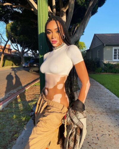 Winnie Harlow Sexy After Self Isolation TheFappening Pro 3 400x500 - Winnie Harlow Sexy After Two Months Of Self-Isolation (6 Photos)