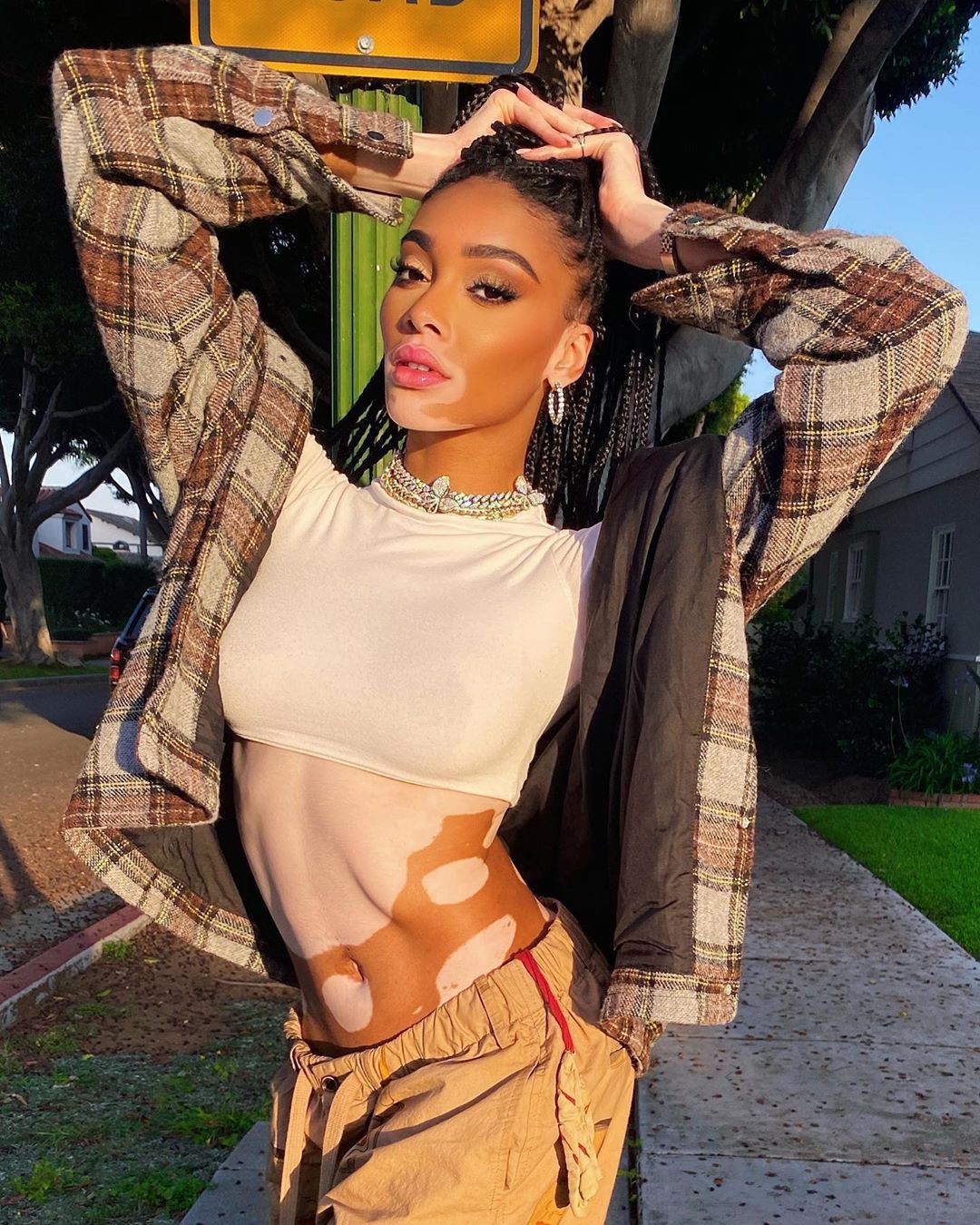 Winnie Harlow Sexy After Self Isolation TheFappening Pro 4 - Winnie Harlow Sexy After Two Months Of Self-Isolation (6 Photos)