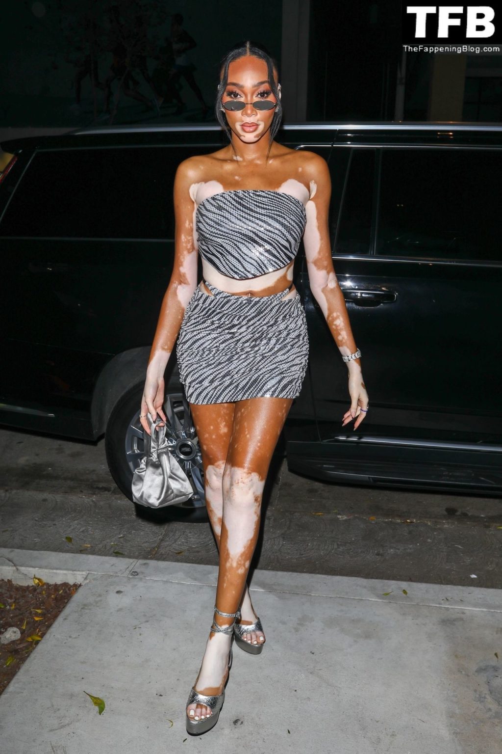 Winnie Harlow Sexy The Fappening Blog 12 1024x1536 - Winnie Harlow Arrives at the Revolve Clothing Store Event in LA (43 Photos)